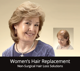 womens-hair-replacement-rochester-ny
